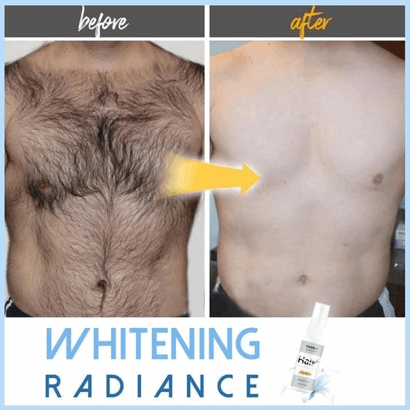 (đ„Summer Hot Sale 50% OFF) Semi-permanent Hair Removal Spray - BUY 4 FREE SHIPPING