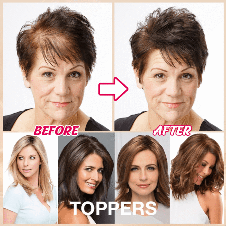 HOT SALE🔥 45% OFF|SHORT NATURAL HAIR TOPPERS