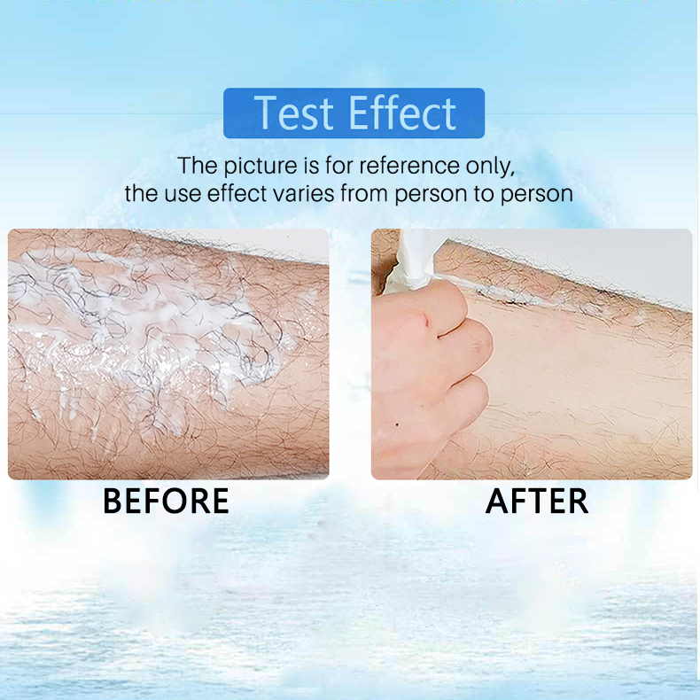 đ„ Magic Hair Removal & Hair InhibitorăBuy 5+ Get Extra 25% OFFă