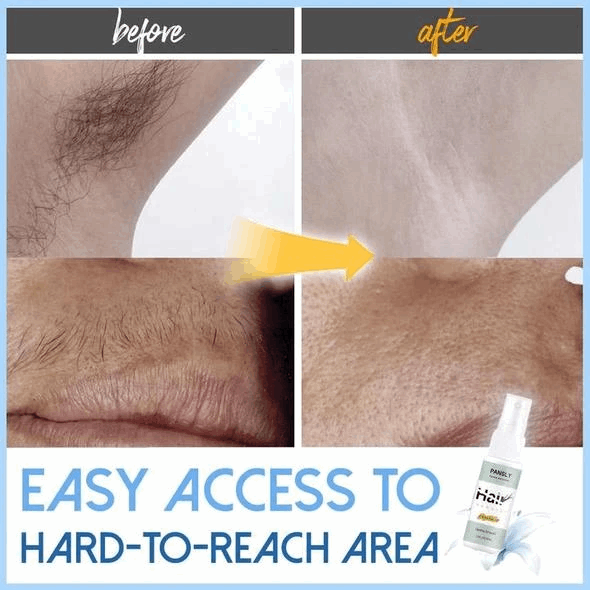 (đ„Summer Hot Sale 50% OFF) Semi-permanent Hair Removal Spray - BUY 4 FREE SHIPPING