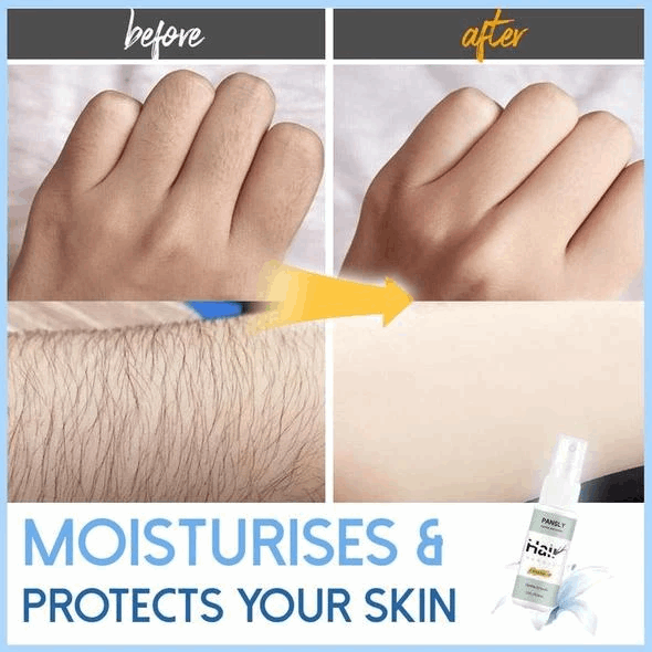 (đ„Summer Hot Sale 50% OFF) Semi-permanent Hair Removal Spray - BUY 4 FREE SHIPPING