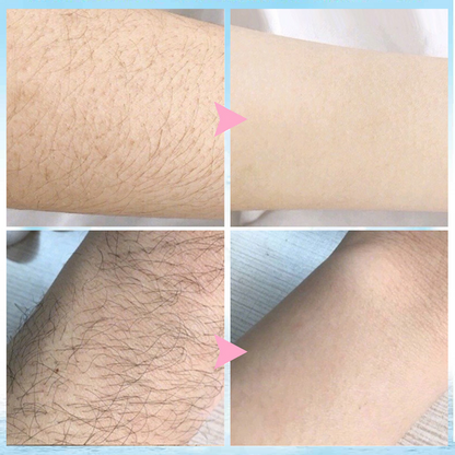 🔥 Magic Hair Removal & Hair Inhibitor【Buy 5+ Get Extra 25% OFF】